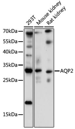 Western blot - AQP2 antibody (A16209)