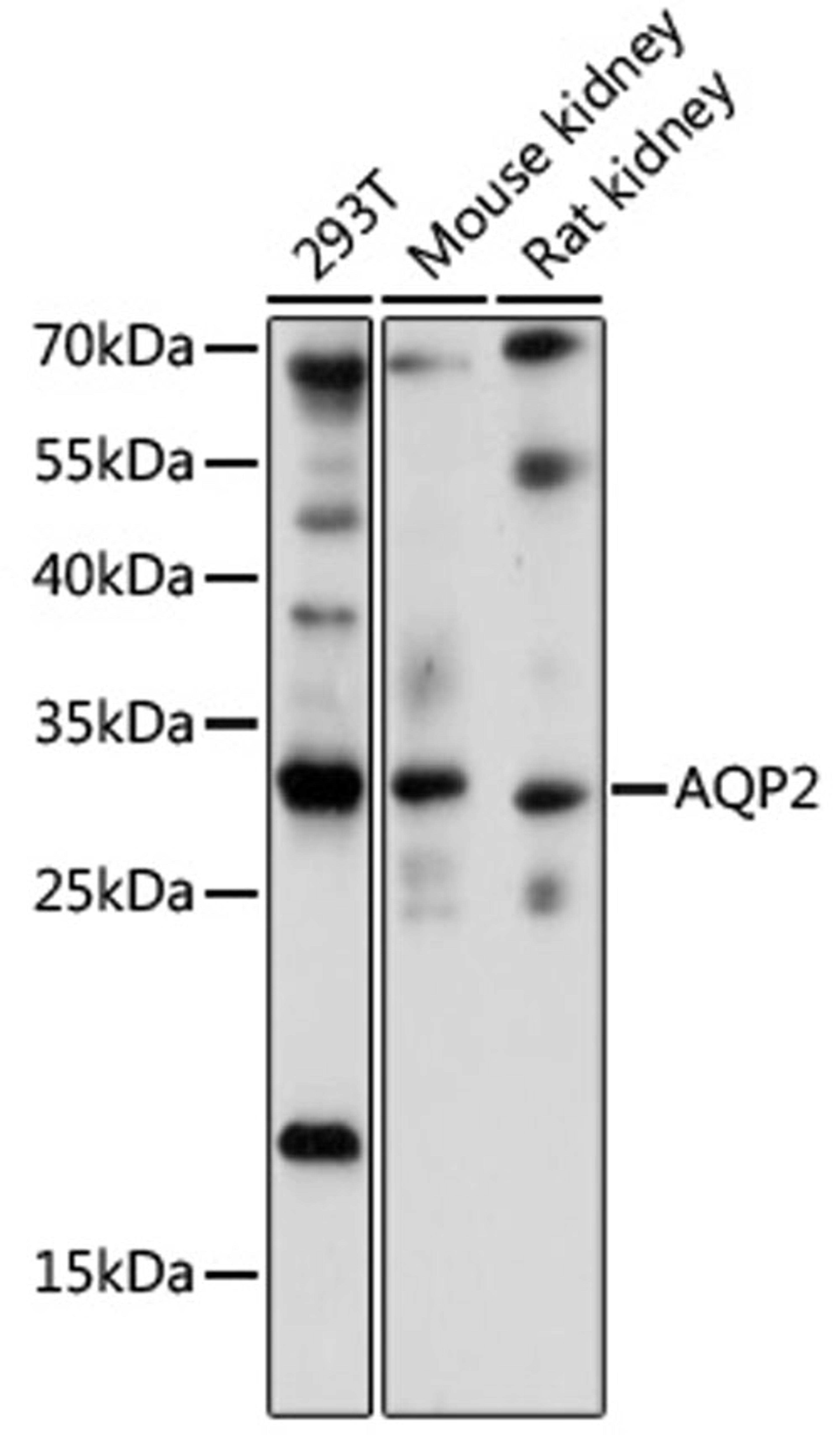 Western blot - AQP2 antibody (A16209)