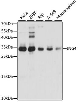 Western blot - ING4 antibody (A5833)