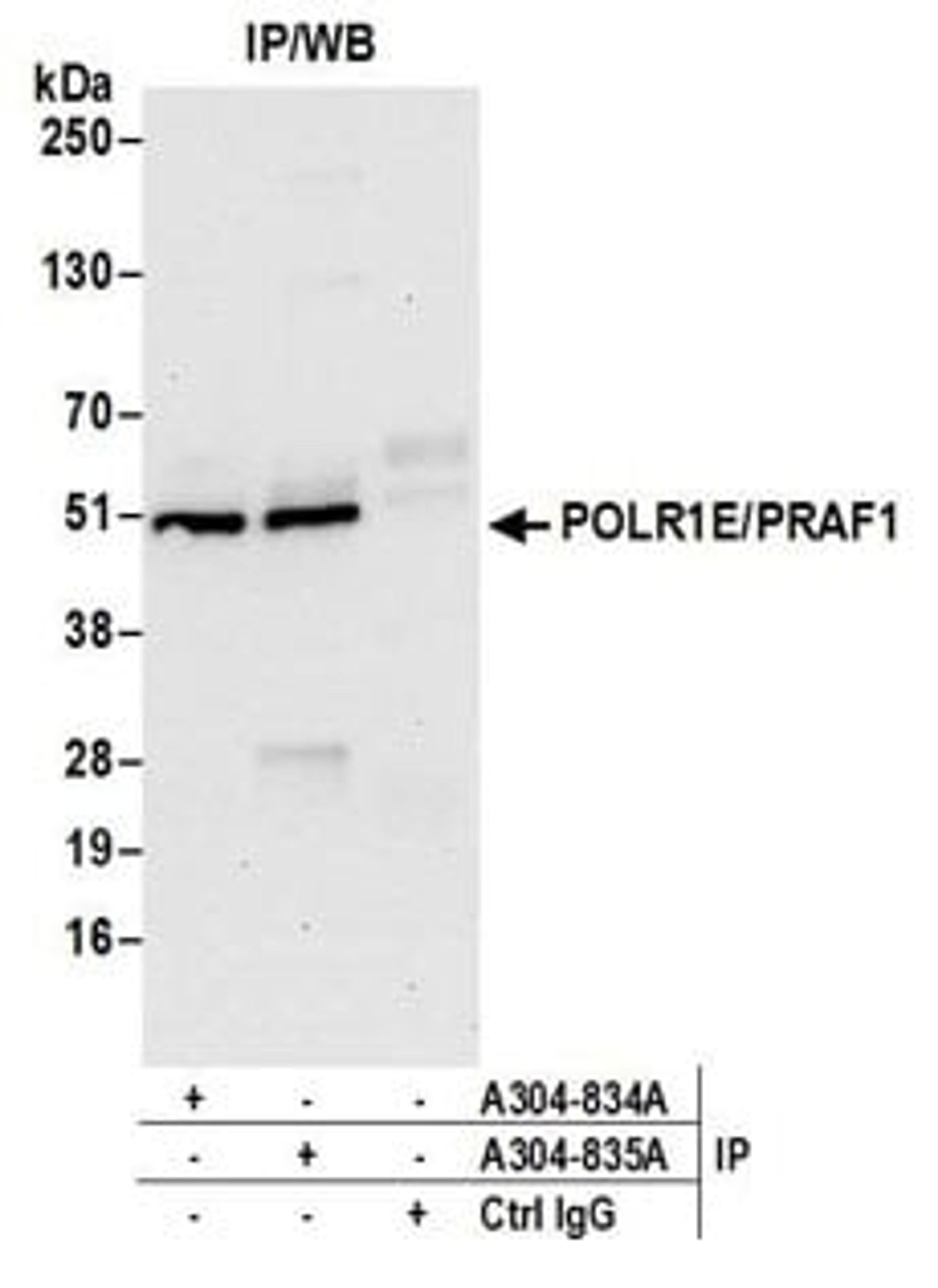 Detection of human POLR1E/PRAF1 by western blot of immunoprecipitates.