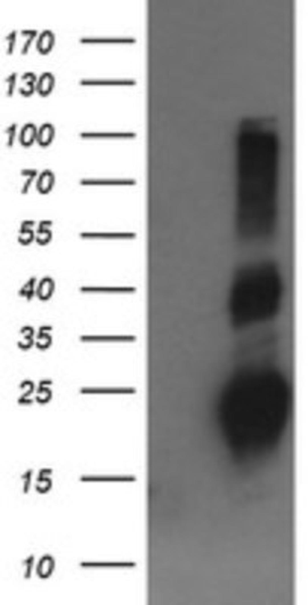 Western Blot: RHOJ Antibody (1D7) [NBP2-45590] - Analysis of HEK293T cells were transfected with the pCMV6-ENTRY control (Left lane) or pCMV6-ENTRY RHOJ.