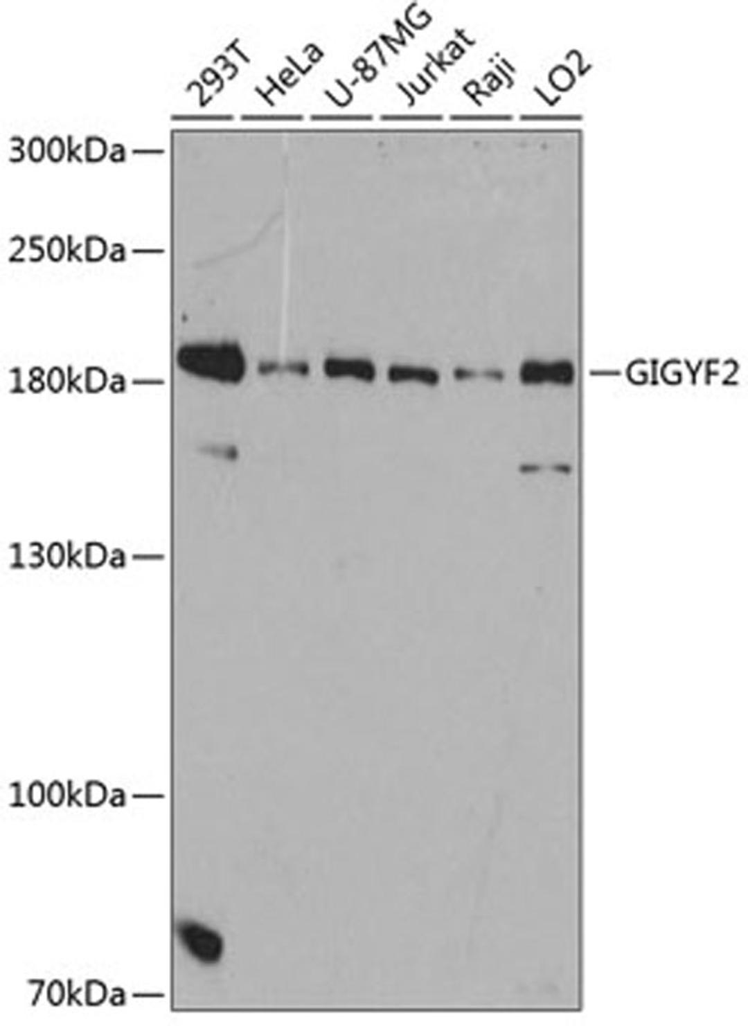 Western blot - GIGYF2 antibody (A12069)