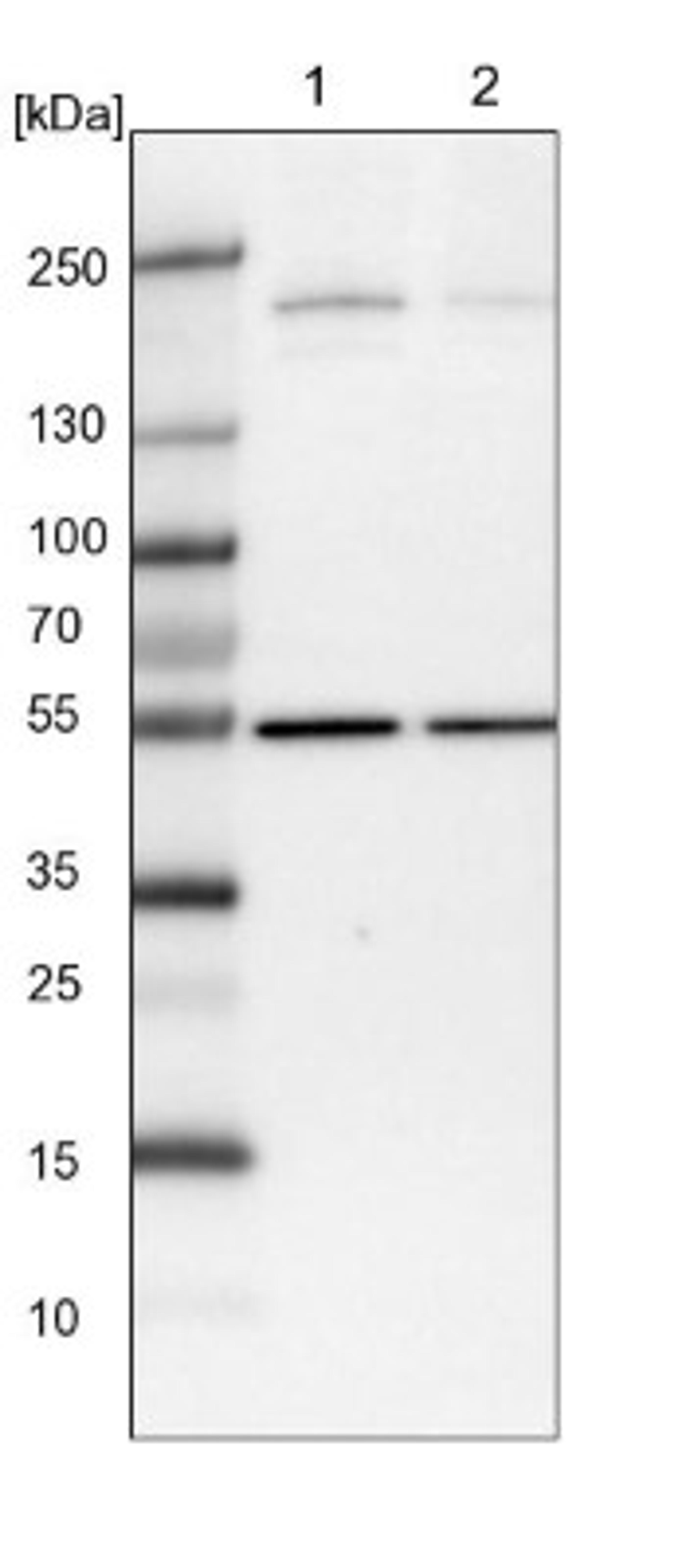 Western Blot: Synaptojanin 2 Antibody [NBP1-87843] - Lane 1: NIH-3T3 cell lysate (Mouse embryonic fibroblast cells)<br/>Lane 2: NBT-II cell lysate (Rat Wistar bladder tumour cells)