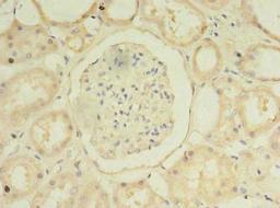 Immunohistochemistry of paraffin-embedded human kidney tissue using CSB-PA713104LA01HU at dilution of 1:100