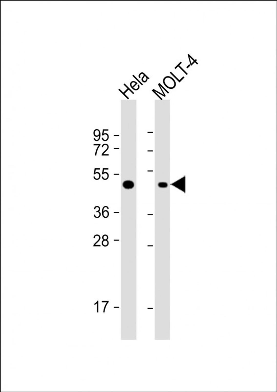 Western Blot at 1:1000 dilution Lane 1: Hela whole cell lysate Lane 2: MOLT-4 whole cell lysate Lysates/proteins at 20 ug per lane.