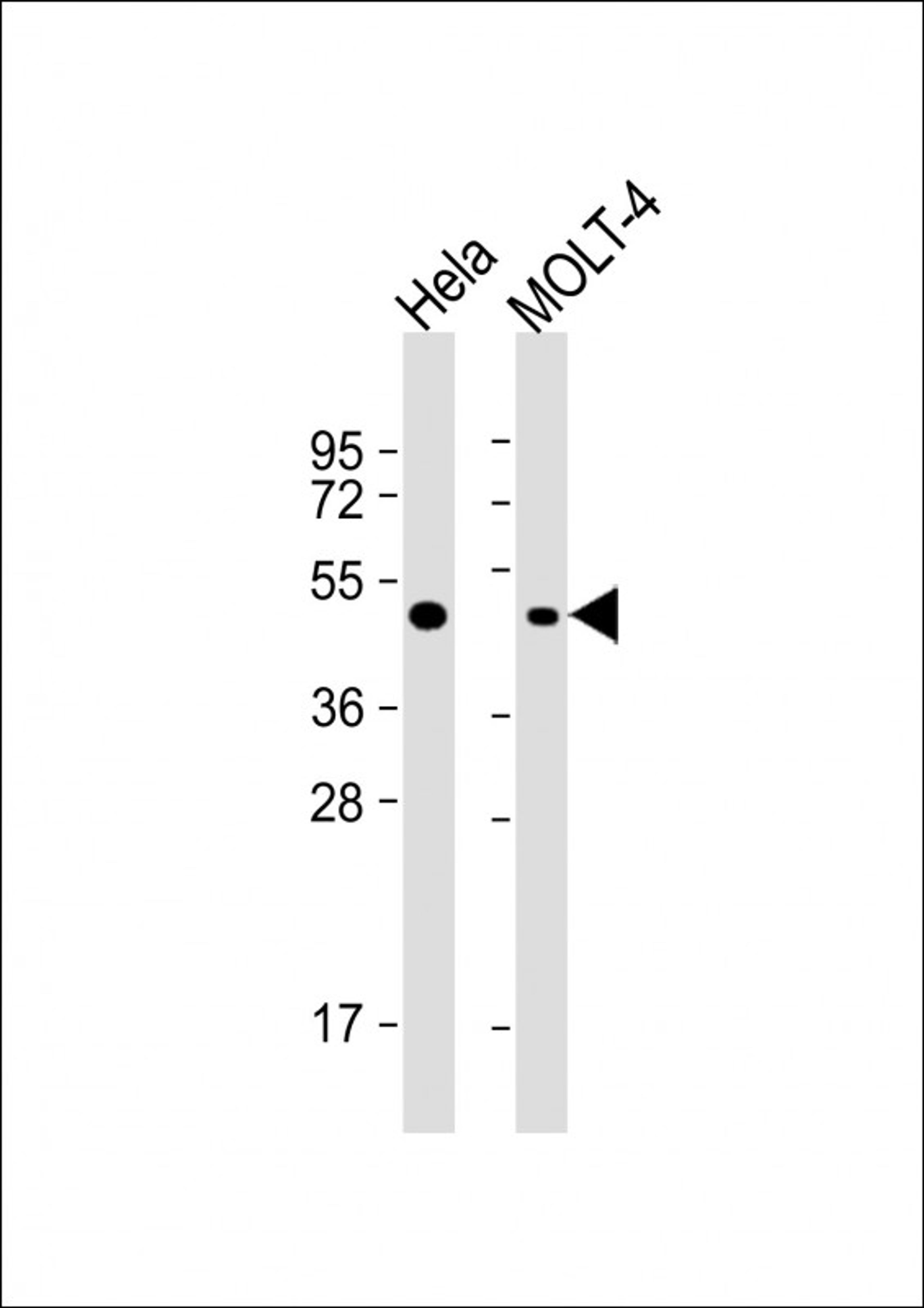 Western Blot at 1:1000 dilution Lane 1: Hela whole cell lysate Lane 2: MOLT-4 whole cell lysate Lysates/proteins at 20 ug per lane.