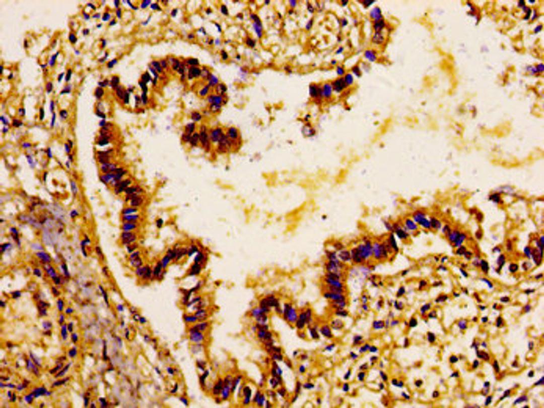 IHC image of CSB-PA883618LA01HU diluted at 1:100 and staining in paraffin-embedded human lung tissue performed on a Leica BondTM system. After dewaxing and hydration, antigen retrieval was mediated by high pressure in a citrate buffer (pH 6.0). Section was blocked with 10% normal goat serum 30min at RT. Then primary antibody (1% BSA) was incubated at 4°C overnight. The primary is detected by a biotinylated secondary antibody and visualized using an HRP conjugated SP system.