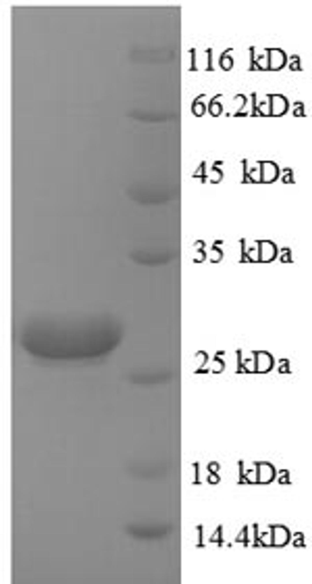 (Tris-Glycine gel) Discontinuous SDS-PAGE (reduced) with 5% enrichment gel and 15% separation gel.