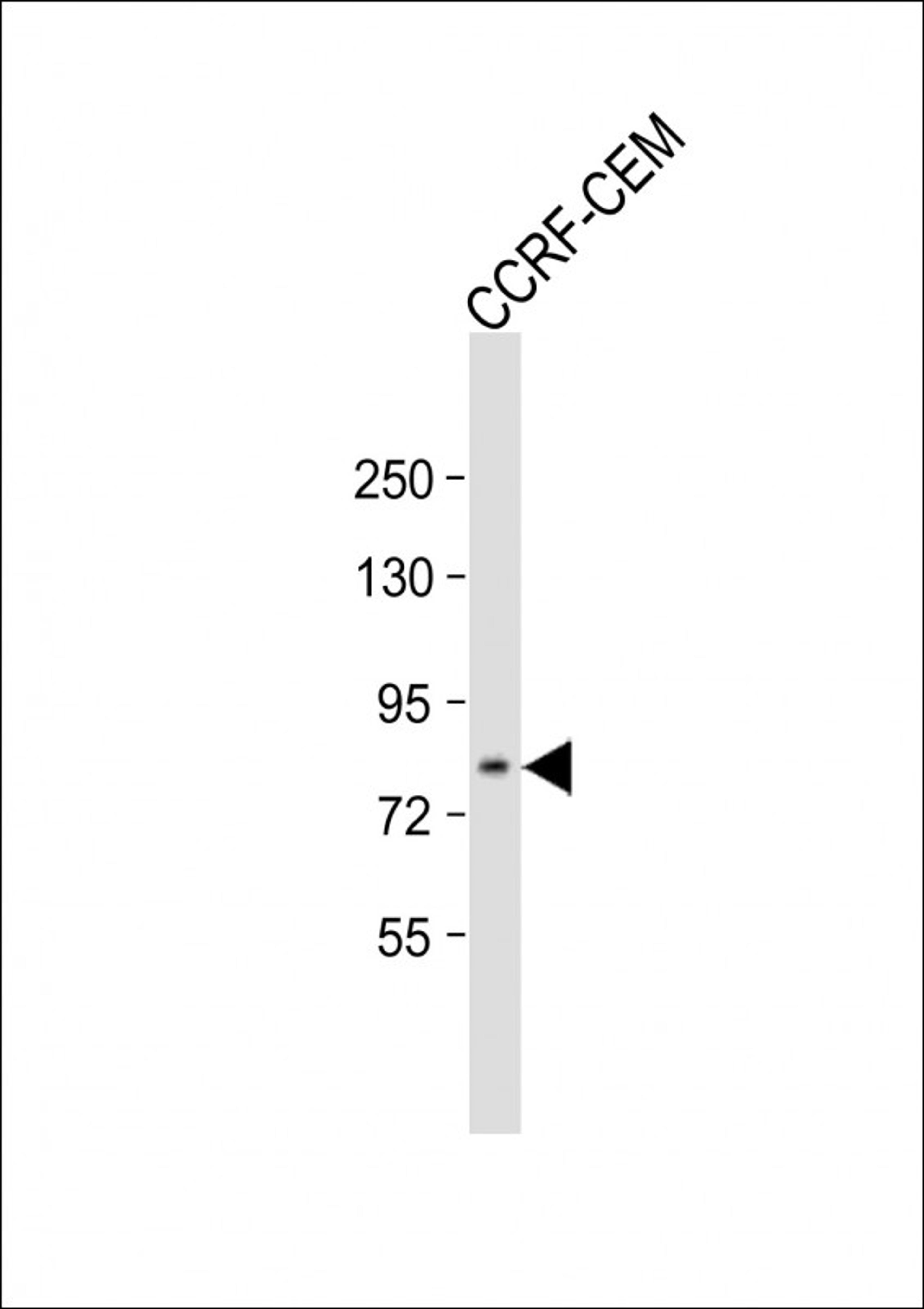 Western Blot at 1:500 dilution