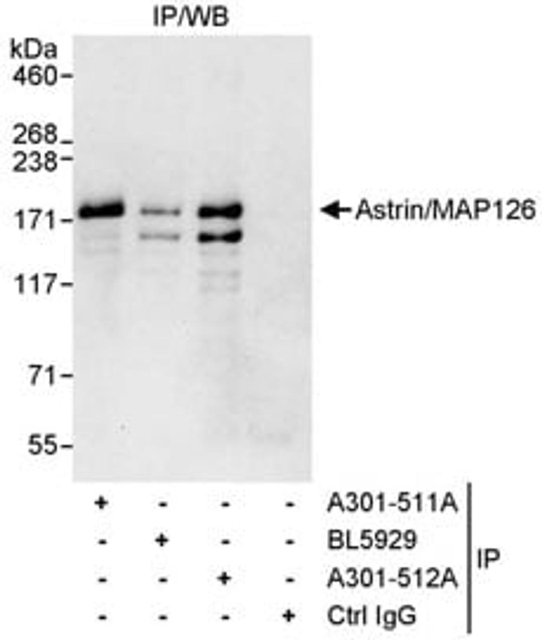 Detection of human Astrin/MAP126 by western blot of immunoprecipitates.