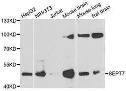 Western blot analysis of extracts of various cell lines using SEPT7 antibody