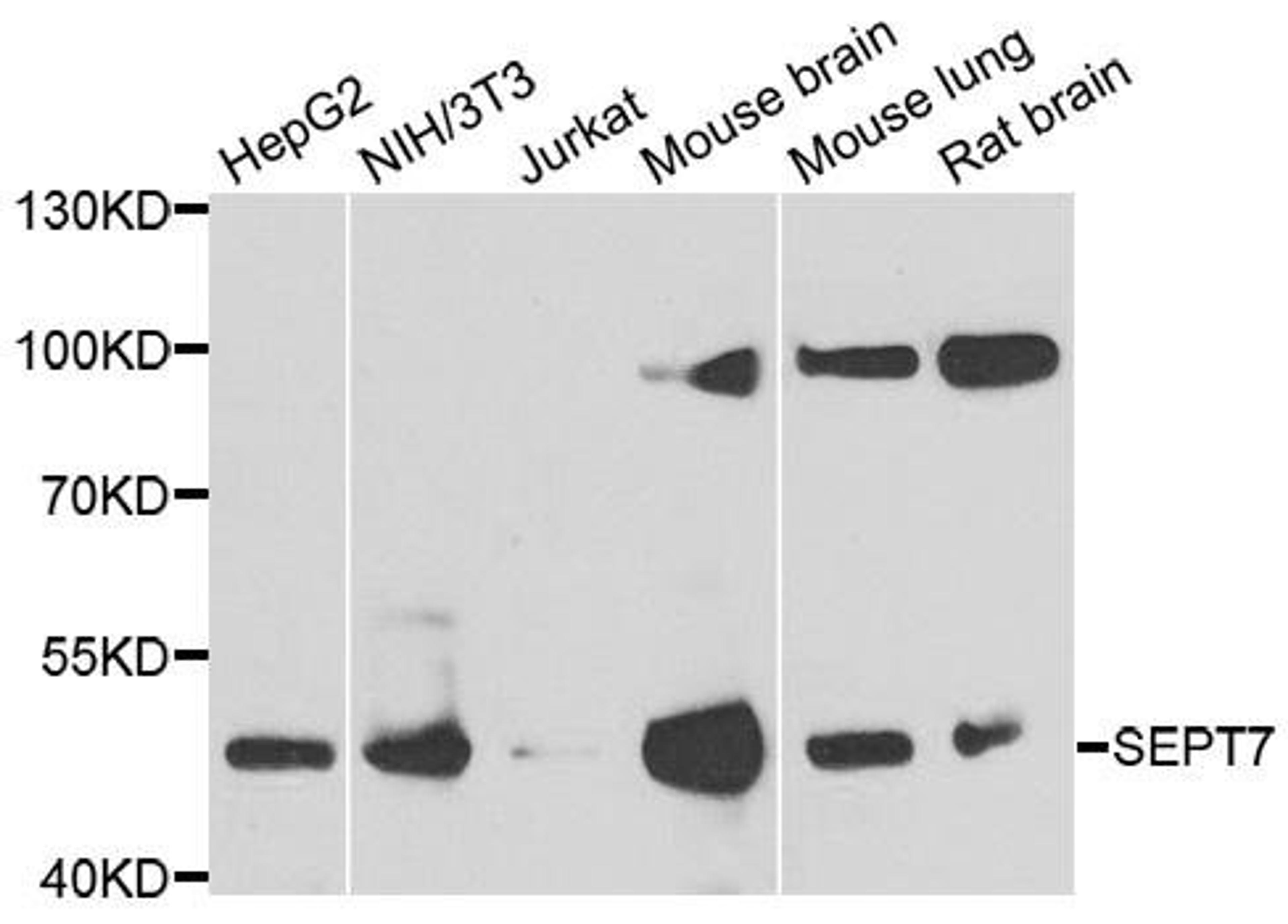 Western blot analysis of extracts of various cell lines using SEPT7 antibody