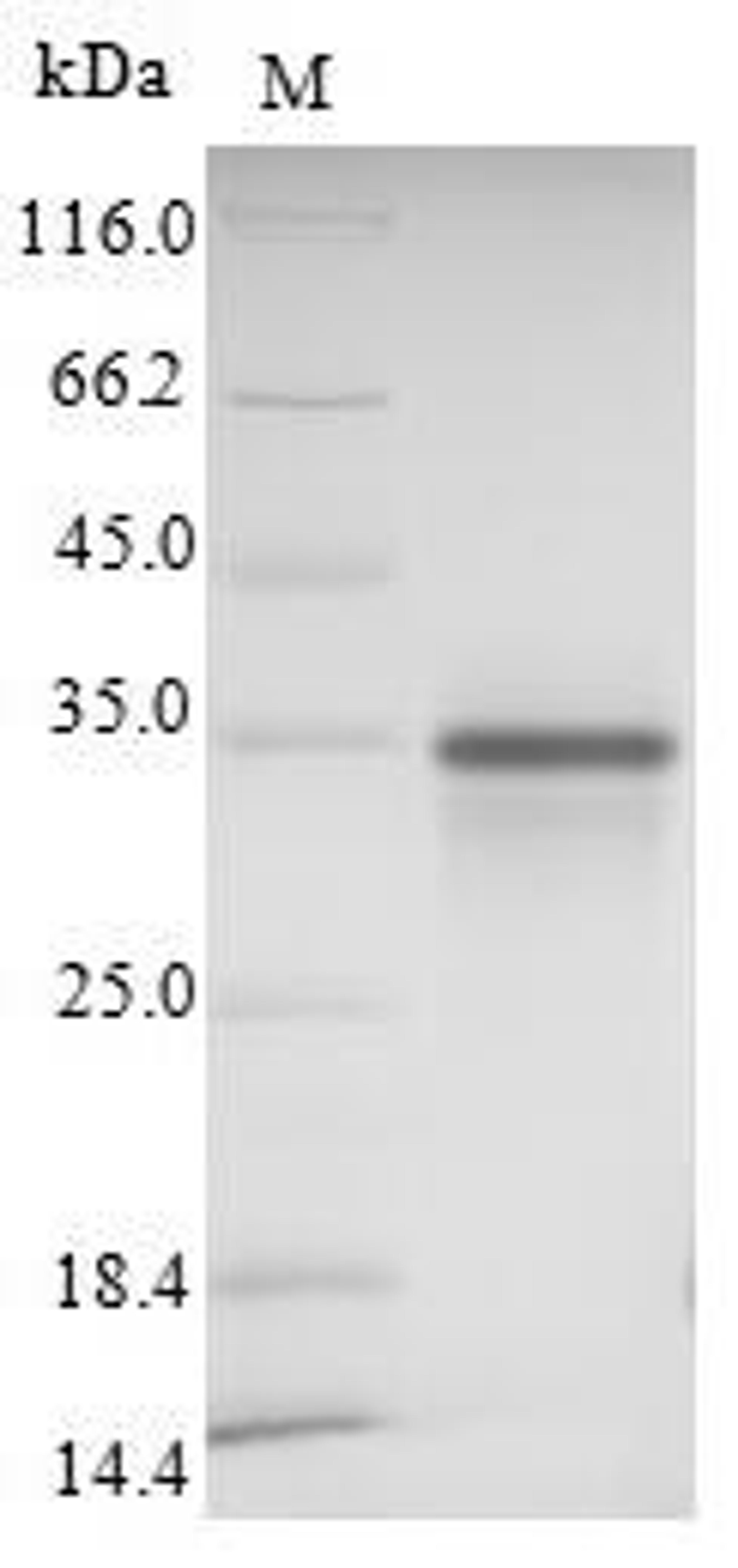 (Tris-Glycine gel) Discontinuous SDS-PAGE (reduced) with 5% enrichment gel and 15% separation gel.