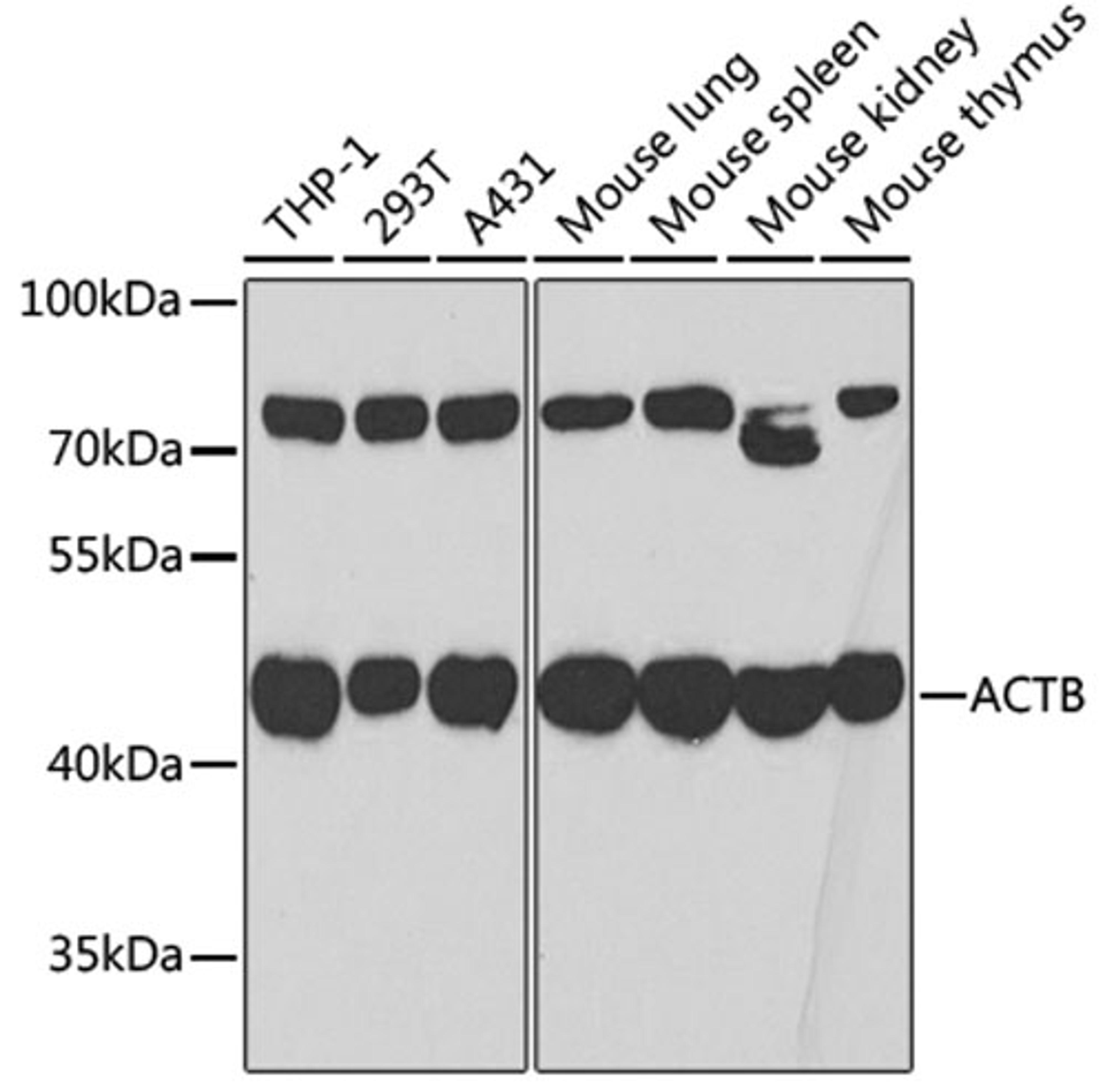 Western blot - ß-actin antibody (AC006)