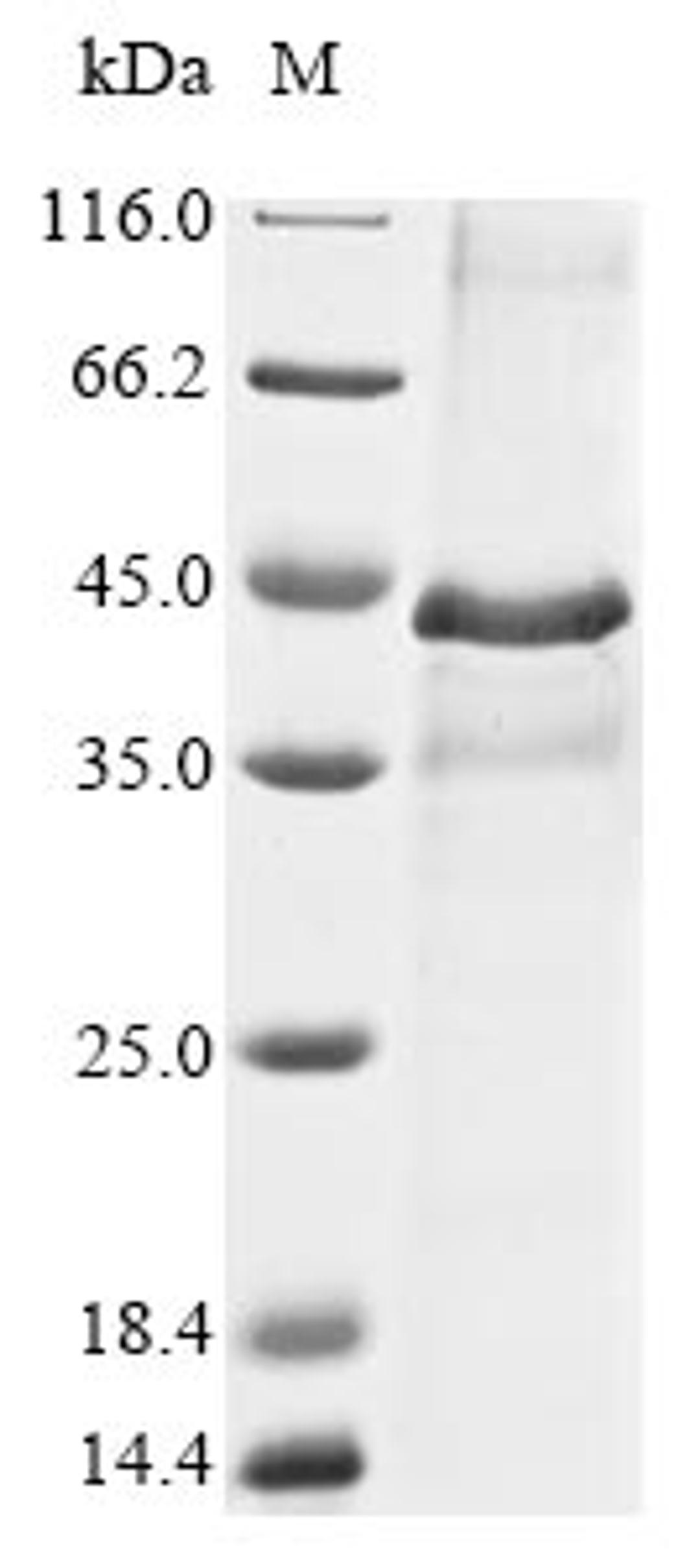 (Tris-Glycine gel) Discontinuous SDS-PAGE (reduced) with 5% enrichment gel and 15% separation gel.