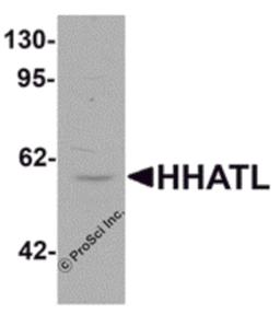 Western blot analysis of HHATL in 3T3 cell lysate with HHATL antibody at 1 μg/mL.