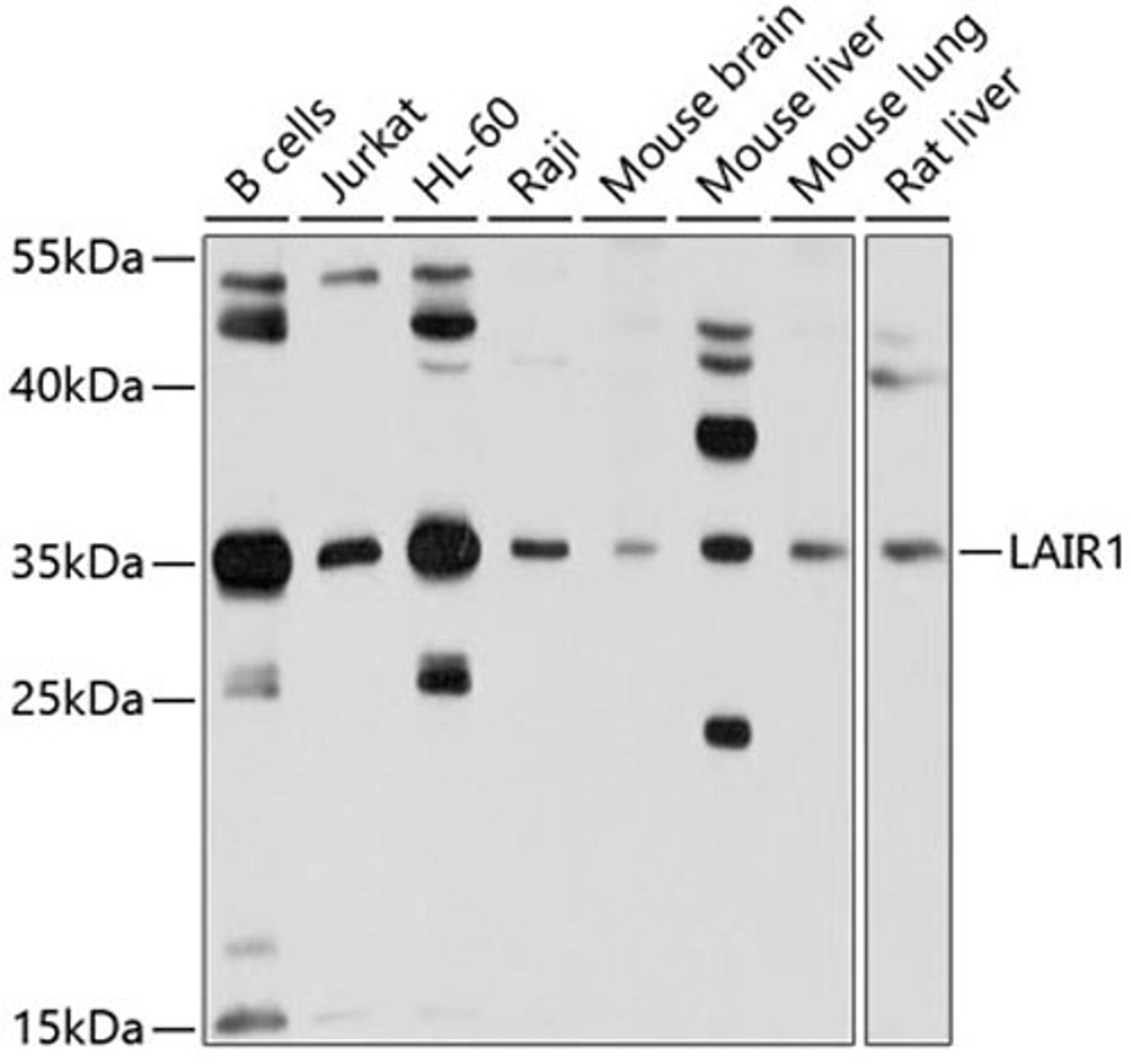 Western blot - LAIR1 antibody (A10120)