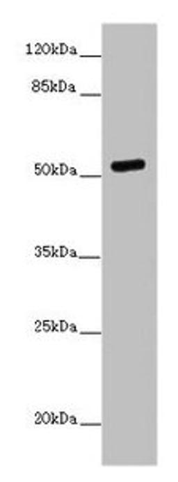 Western blot. All lanes: PRMT3 antibody at 7ug/ml + MCF-7 whole cell lysate. Secondary. Goat polyclonal to rabbit IgG at 1/10000 dilution. Predicted band size: 60, 53 kDa. Observed band size: 53 kDa. 