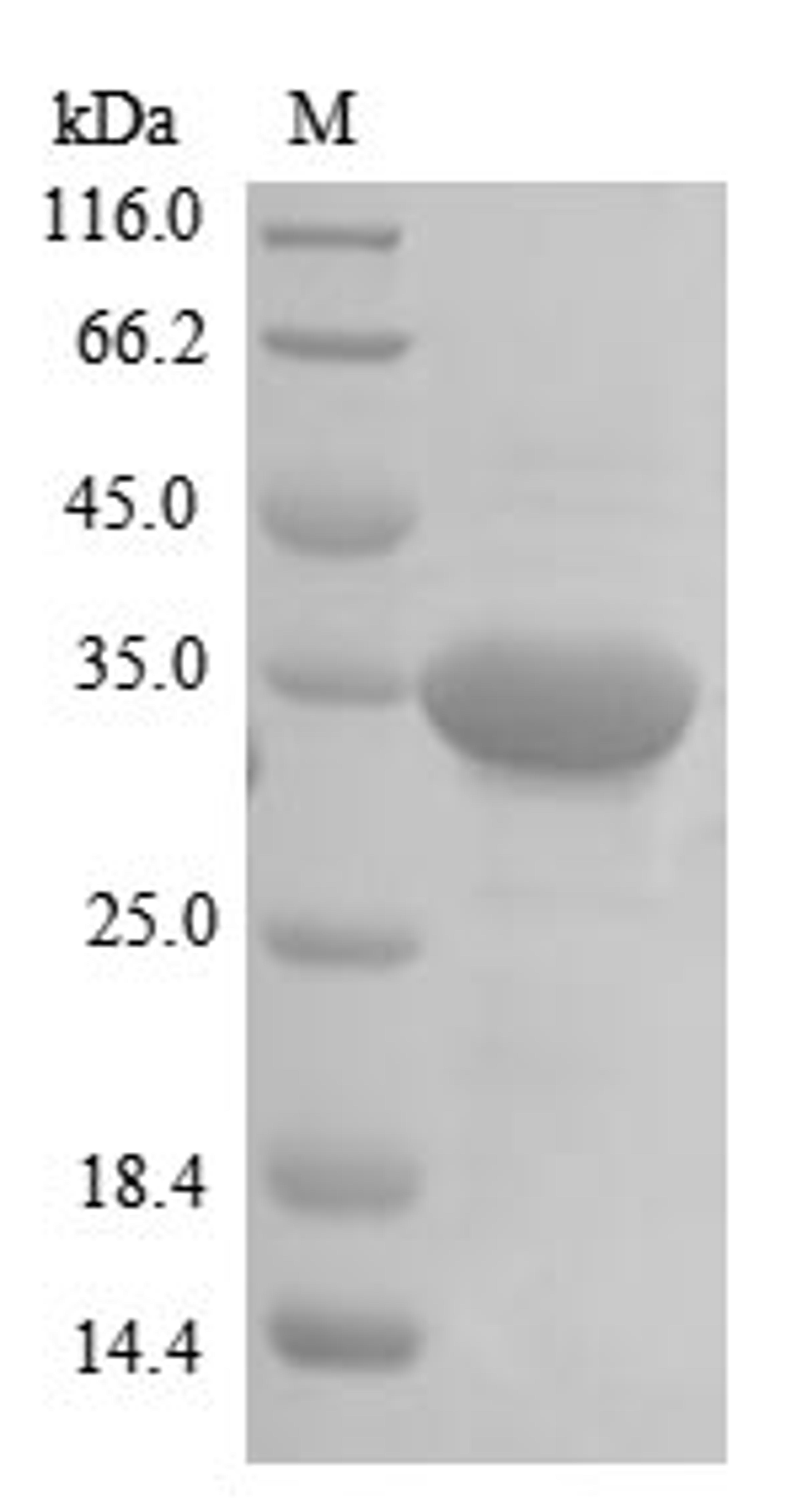 (Tris-Glycine gel) Discontinuous SDS-PAGE (reduced) with 5% enrichment gel and 15% separation gel.