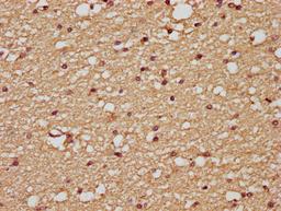 IHC image of CSB-PA07505A0Rb diluted at 1:200 and staining in paraffin-embedded human brain tissue performed on a Leica BondTM system. After dewaxing and hydration, antigen retrieval was mediated by high pressure in a citrate buffer (pH 6.0). Section was blocked with 10% normal goat serum 30min at RT. Then primary antibody (1% BSA) was incubated at 4&deg;C overnight. The primary is detected by a biotinylated secondary antibody and visualized using an HRP conjugated SP system.