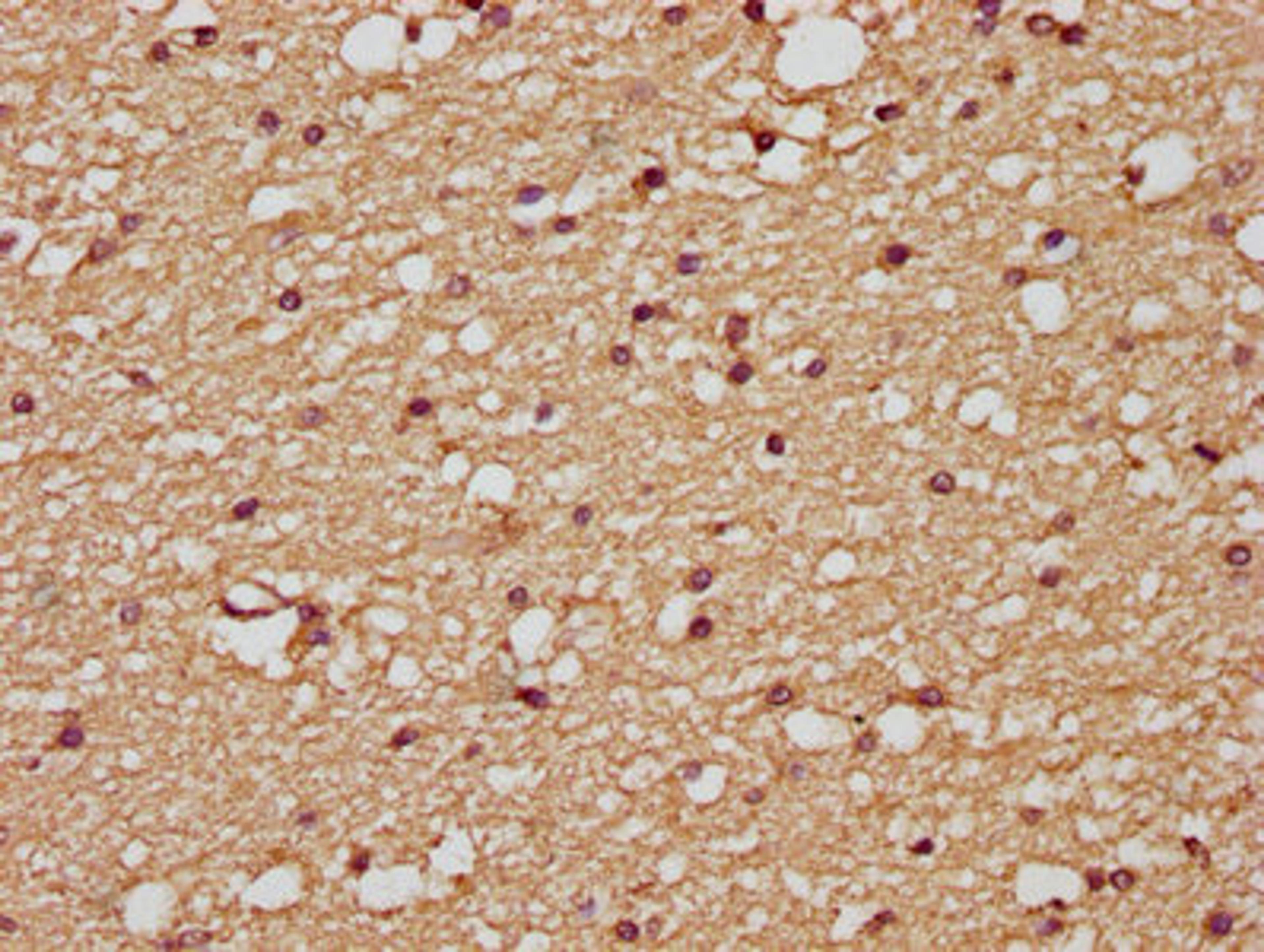 IHC image of CSB-PA07505A0Rb diluted at 1:200 and staining in paraffin-embedded human brain tissue performed on a Leica BondTM system. After dewaxing and hydration, antigen retrieval was mediated by high pressure in a citrate buffer (pH 6.0). Section was blocked with 10% normal goat serum 30min at RT. Then primary antibody (1% BSA) was incubated at 4&deg;C overnight. The primary is detected by a biotinylated secondary antibody and visualized using an HRP conjugated SP system.