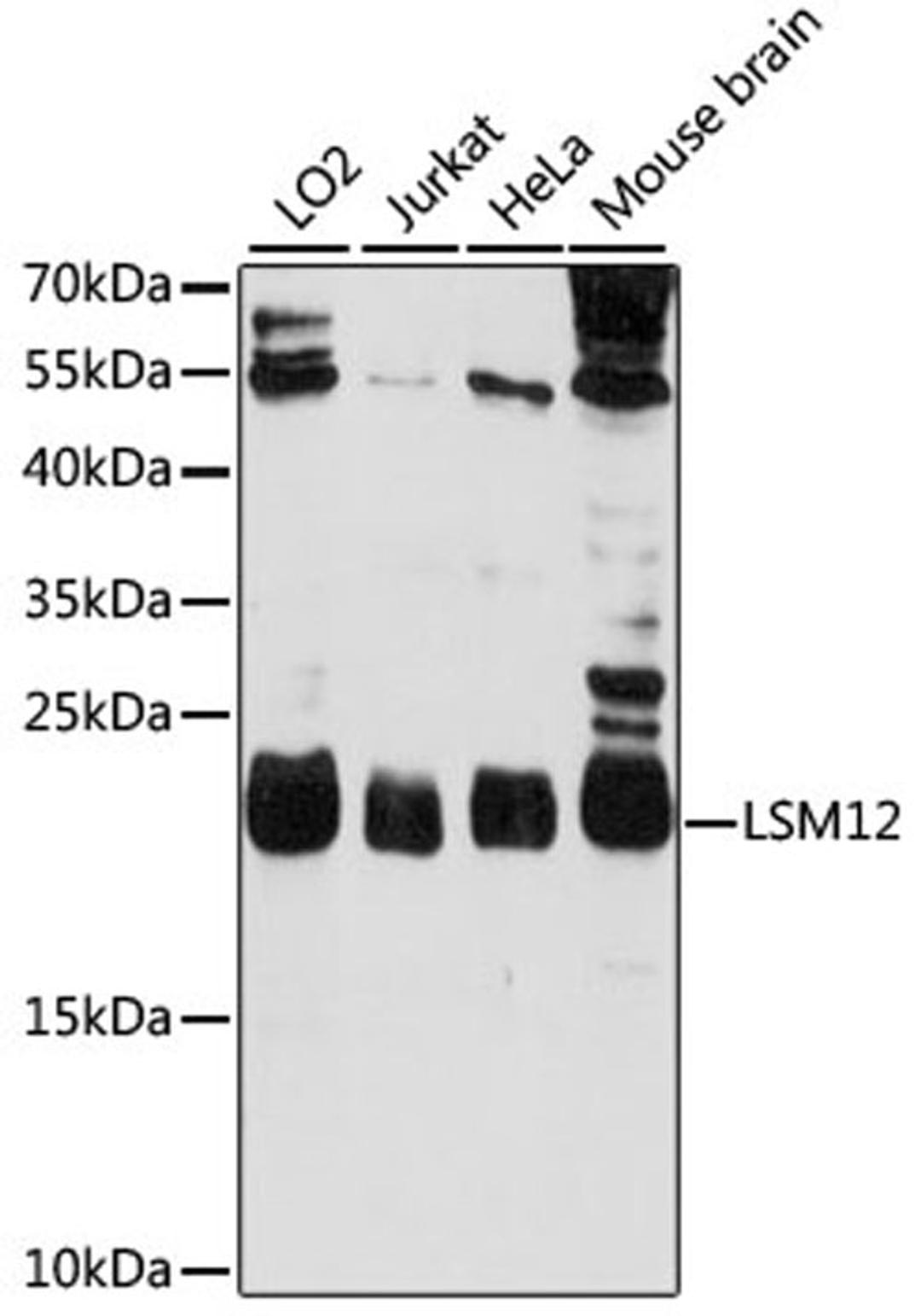 Western blot - LSM12 antibody (A15947)