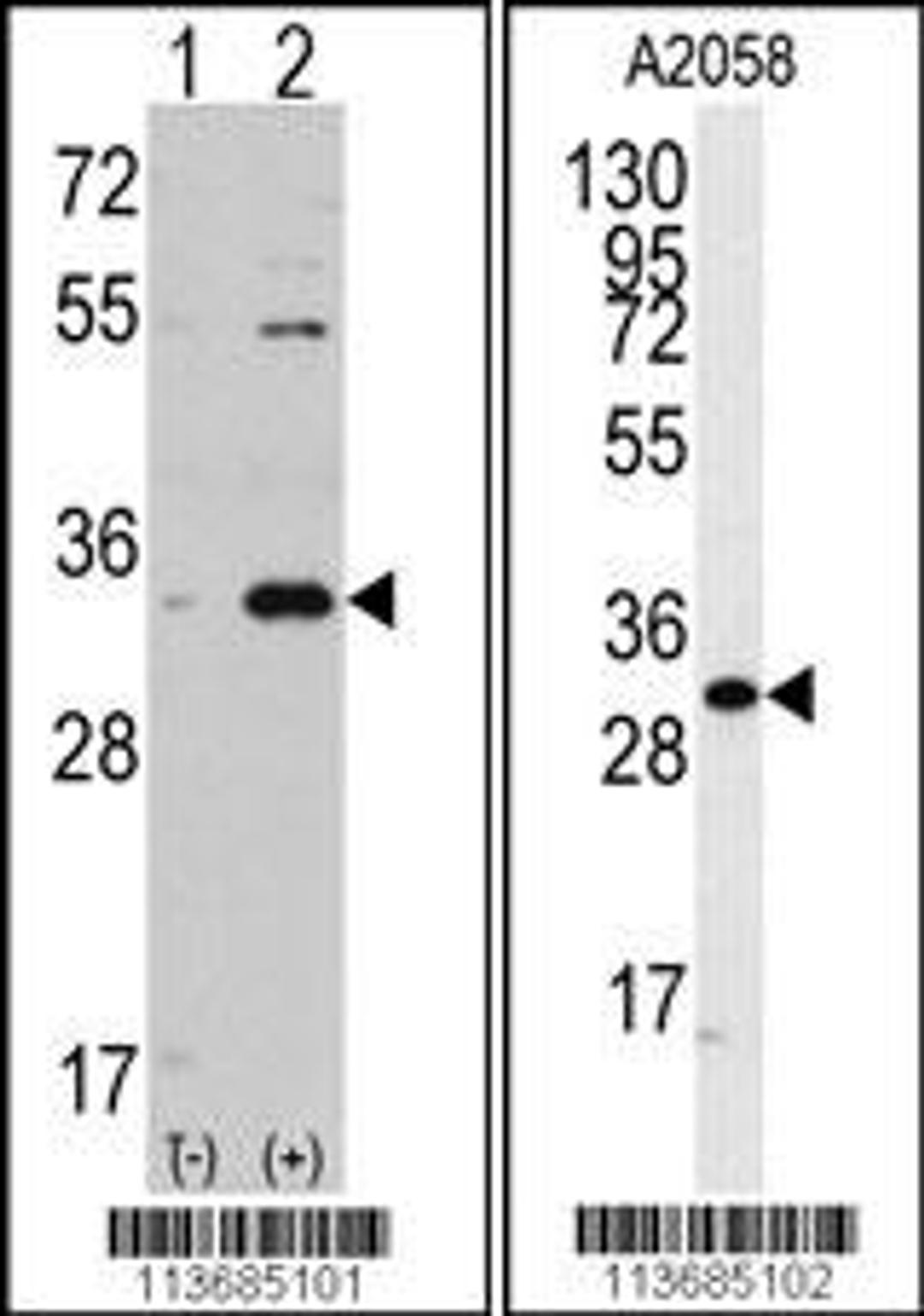 Western blot analysis of CDC2 using rabbit polyclonal CDC2 Antibody.293 cell lysates (2 ug/lane) either nontransfected (Lane 1) or transiently transfected with the CDC2 gene (Lane 2).