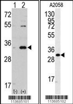 Western blot analysis of CDC2 using rabbit polyclonal CDC2 Antibody.293 cell lysates (2 ug/lane) either nontransfected (Lane 1) or transiently transfected with the CDC2 gene (Lane 2).