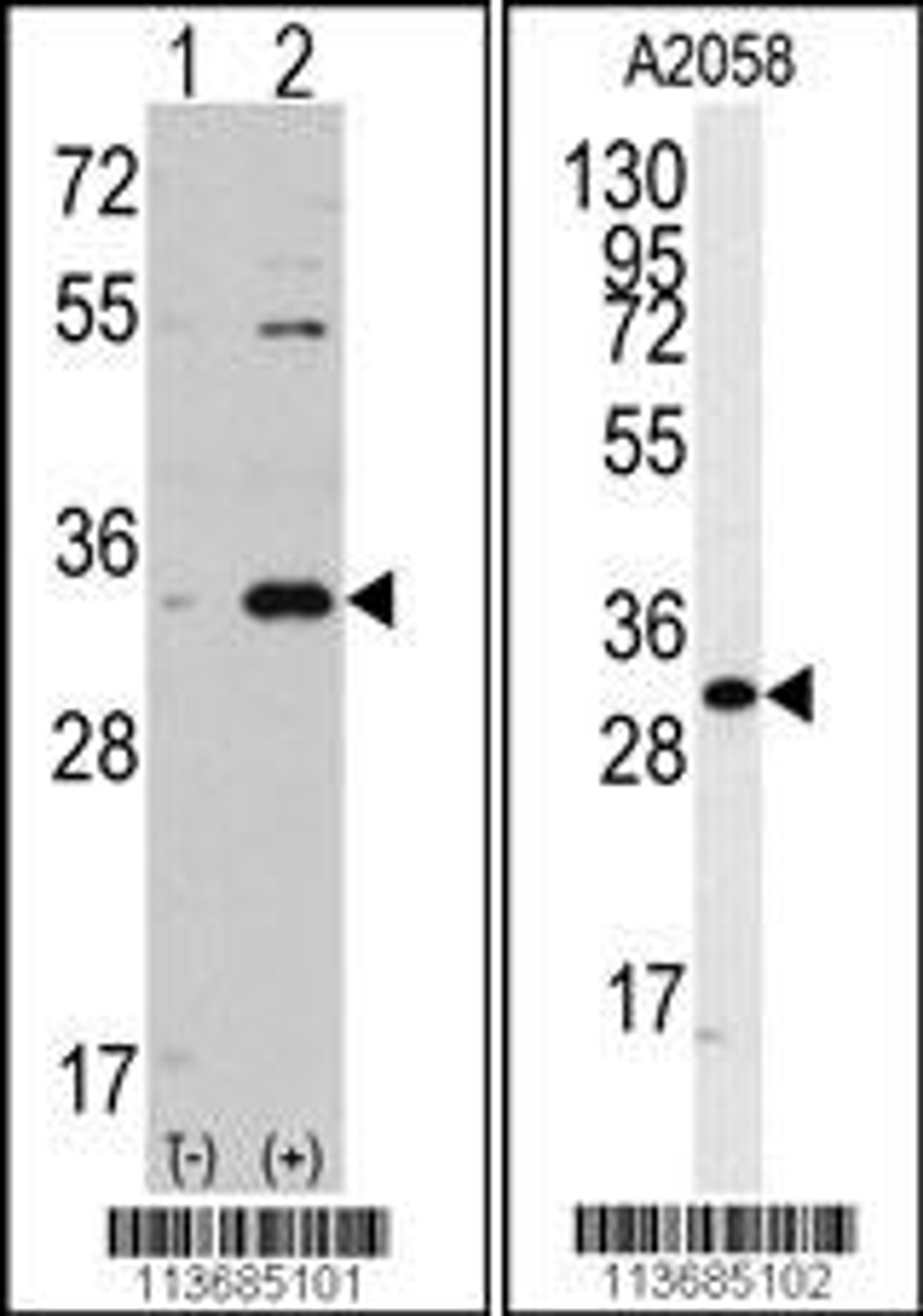 Western blot analysis of CDC2 using rabbit polyclonal CDC2 Antibody.293 cell lysates (2 ug/lane) either nontransfected (Lane 1) or transiently transfected with the CDC2 gene (Lane 2).