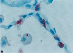 Immunohistochemistry-Paraffin: Surfactant Protein A Antibody (6F10) [NBP2-41344] - Analysis using the Biotin conjugate of NBP2-41344. Staining of sections of human lung