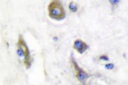 Immunohistochemistry-Paraffin: Parkin Antibody [NB100-91921] - Paraffin-embedded human brain tissue.