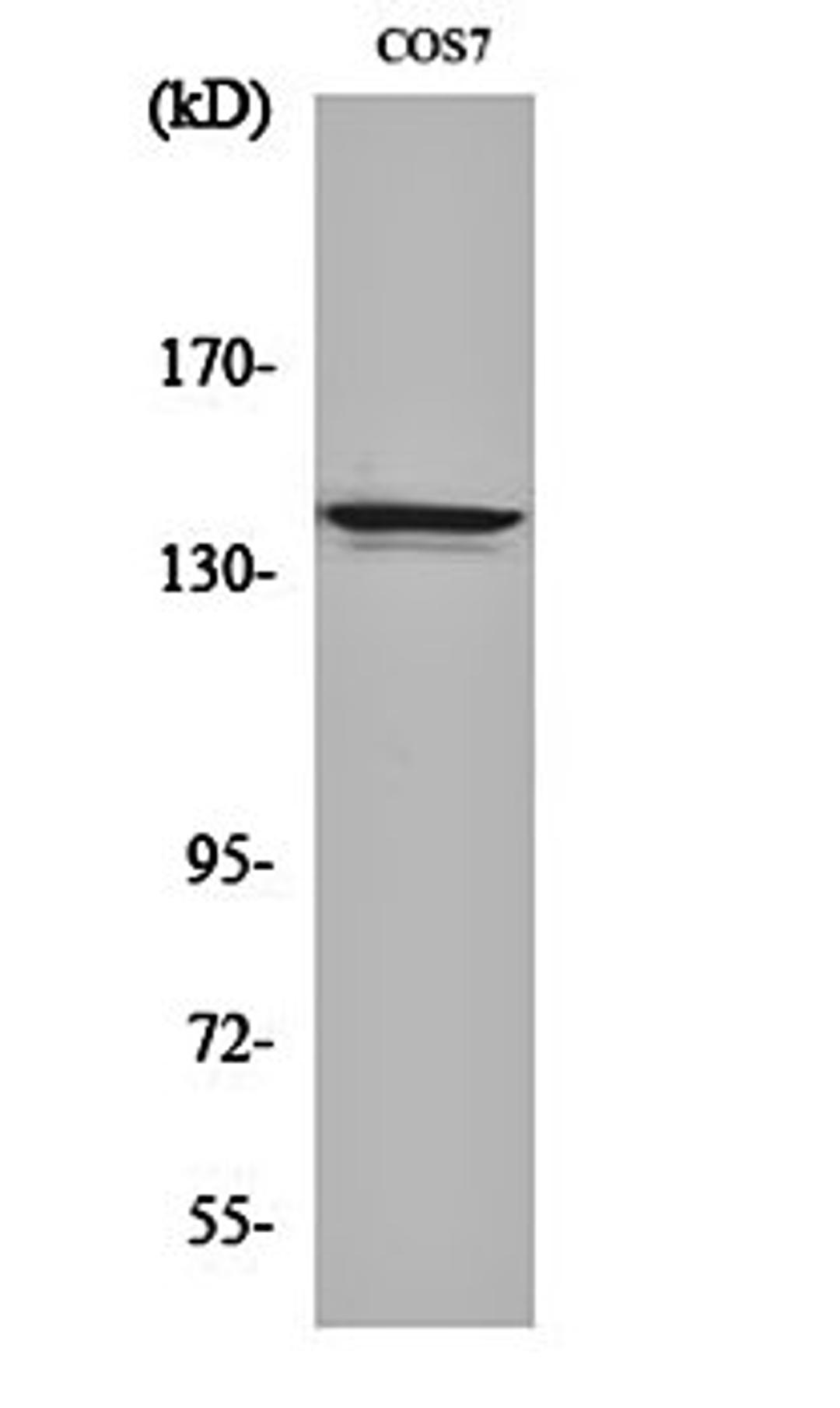 Western blot analysis of COS7 cell lysates using NFR kappa B antibody