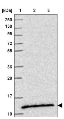 Western Blot: SEC61B Antibody [NBP2-13290] - Lane 1: Marker [kDa] 250, 130, 95, 72, 55, 36, 28, 17, 10<br/>Lane 2: Human cell line RT-4<br/>Lane 3: Human cell line U-251MG sp