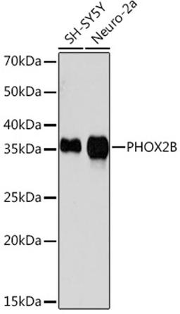 Western blot - PHOX2B Rabbit mAb (A6816)