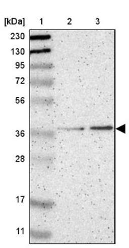 Western Blot: ZSCAN1 Antibody [NBP1-81978] - Lane 1: Marker [kDa] 230, 130, 95, 72, 56, 36, 28, 17, 11<br/>Lane 2: Human cell line RT-4<br/>Lane 3: Human cell line U-251MG sp