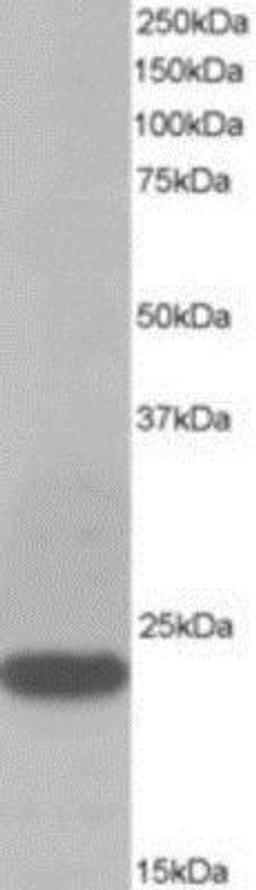 Western Blot: Transgelin/TAGLN/SM22 alpha Antibody [NB600-507] - Analysis of Human Muscle lysate.