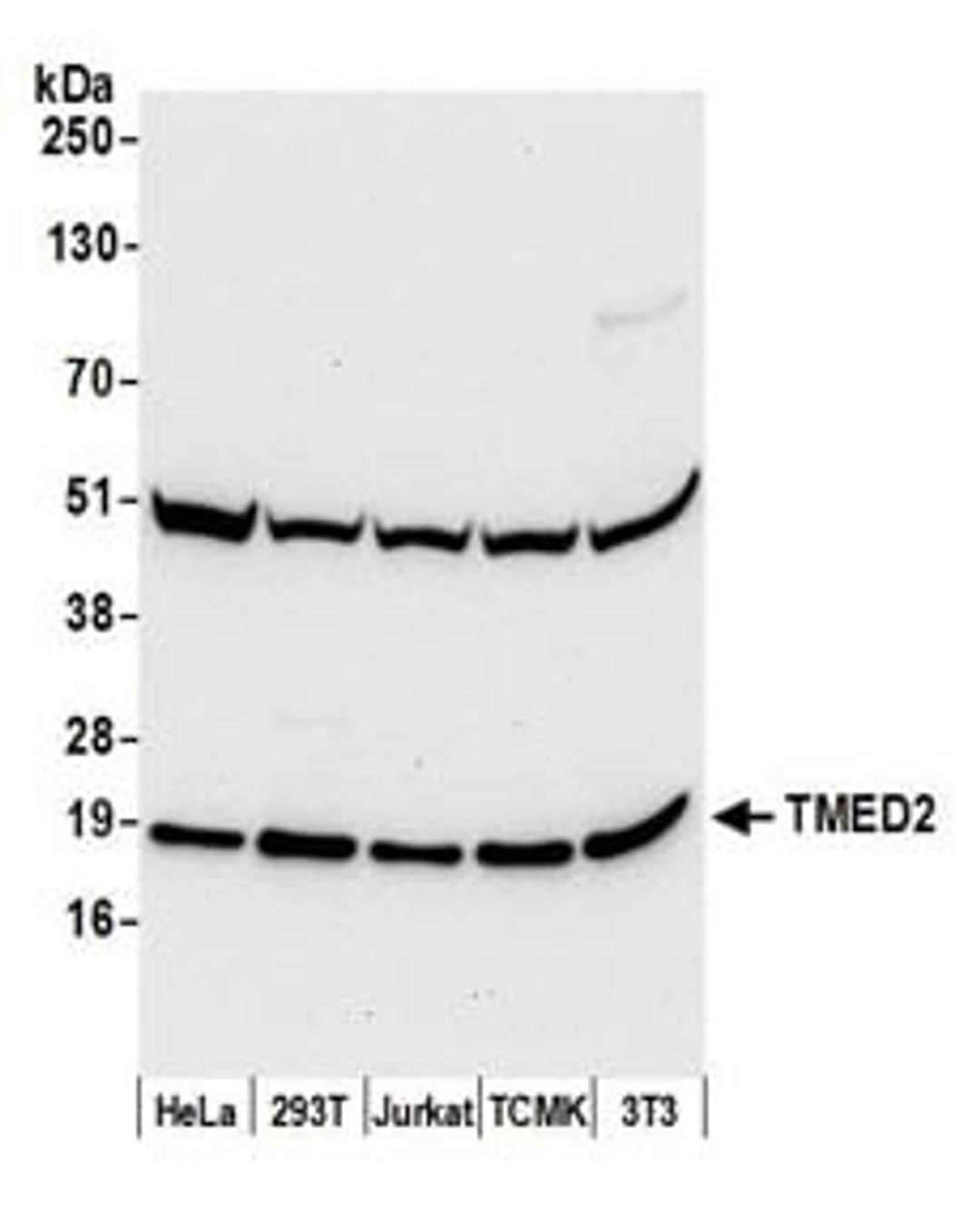 Detection of human and mouse TMED2 by western blot.