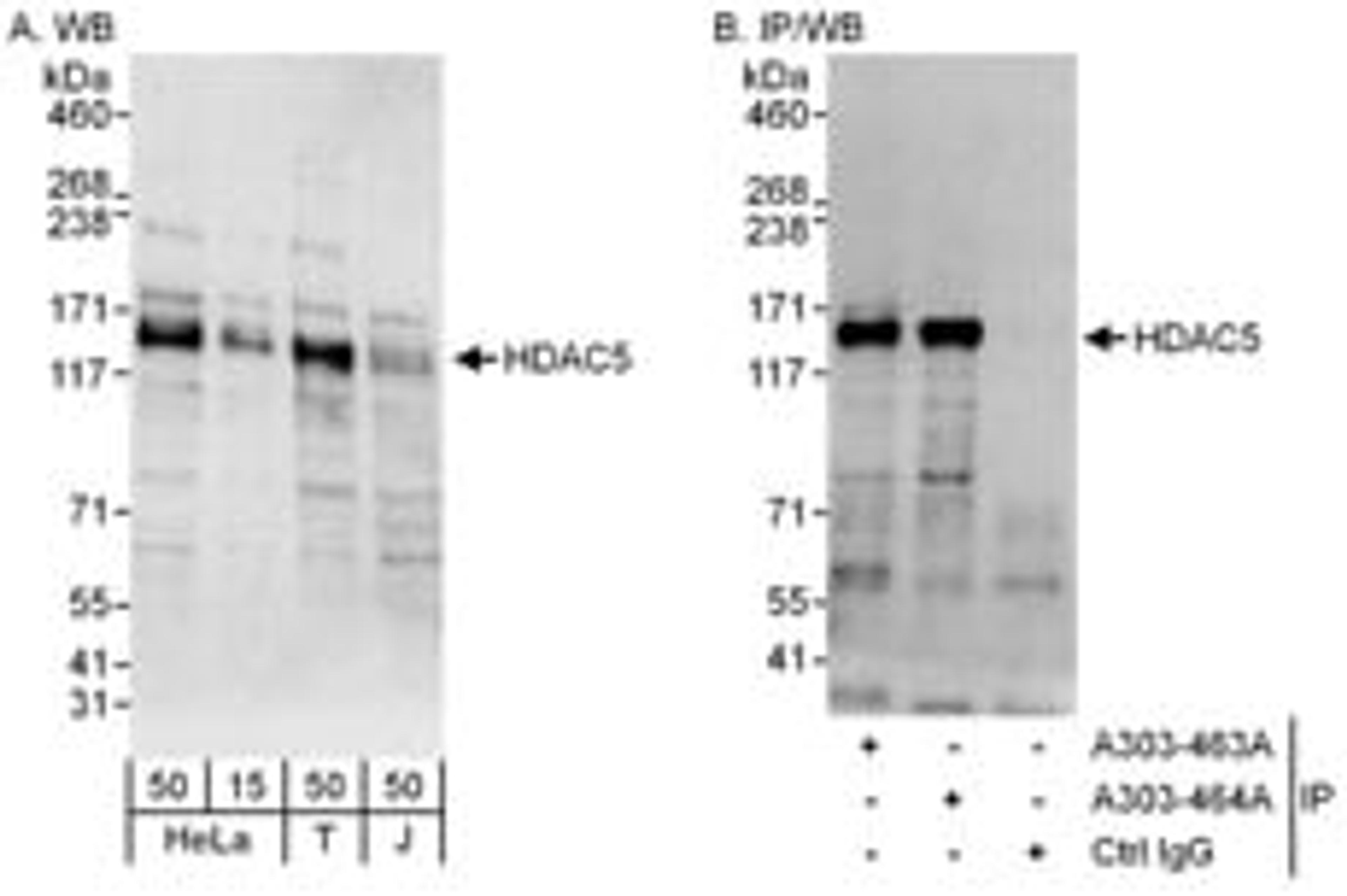 Detection of human HDAC5 by western blot and immunoprecipitation.