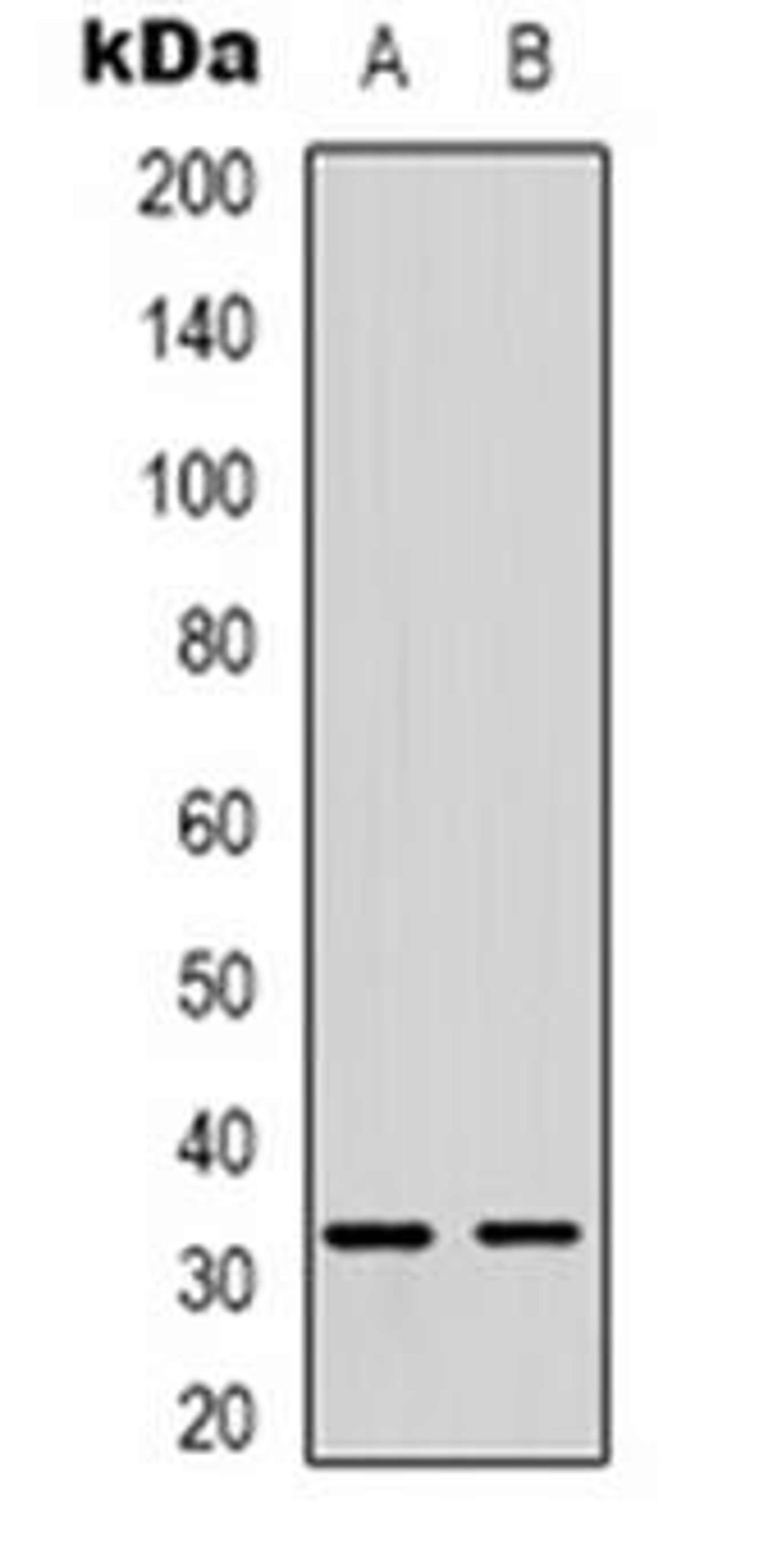 Western blot analysis of FOXE3 expression in SHSYSY (Lane 1), MDAMB435 (Lane 2) whole cell lysates using FOXE3 antibody