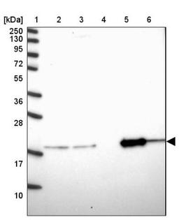 Western Blot: OPA3 Antibody [NBP1-92221] - Lane 1: Marker [kDa] 250, 130, 95, 72, 55, 36, 28, 17, 10<br/>Lane 2: Human cell line RT-4<br/>Lane 3: Human cell line U-251MG sp<br/>Lane 4: Human plasma (IgG/HSA depleted)<br/>Lane 5: Human liver tissue<br/>Lane 6: Human tonsil tissue