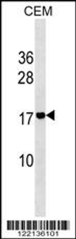 Western blot analysis in CEM cell line lysates (35ug/lane).