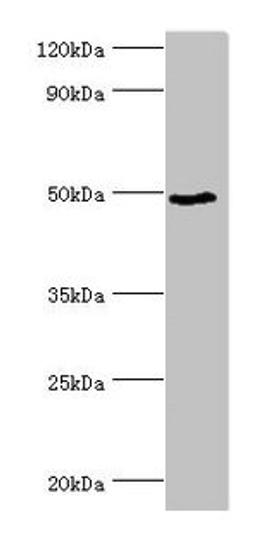 Western blot. All lanes: BANP antibody at 6µg/ml + HepG2 whole cell lysate. Secondary. Goat polyclonal to rabbit IgG at 1/10000 dilution. Predicted band size: 57, 52, 49, 54, 55, 51, 56 kDa. Observed band size: 49 kDa