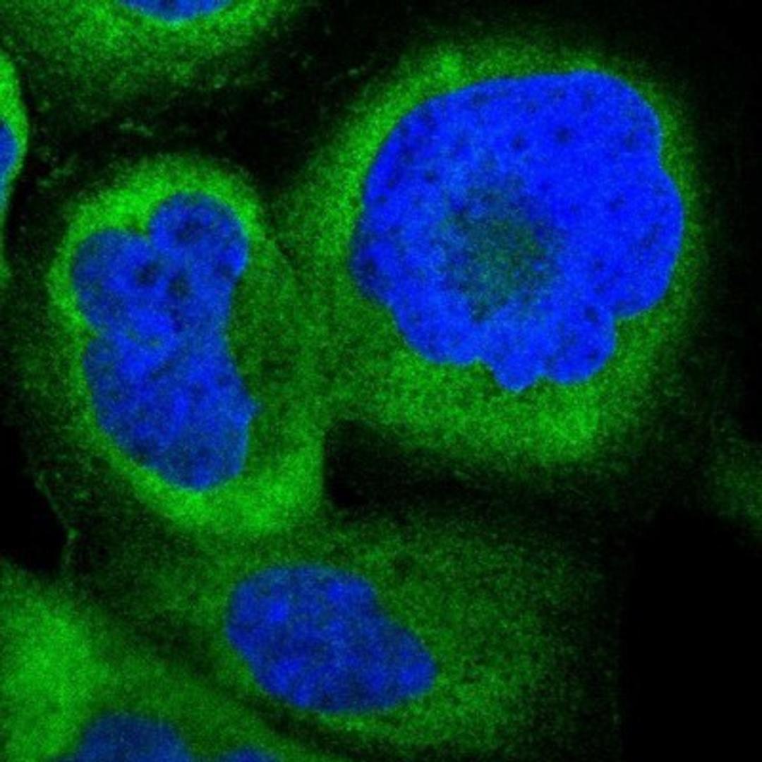 Immunocytochemistry/Immunofluorescence: NME1-NME2 Antibody [NBP1-80992] - Staining of human cell line A-431 shows positivity in cytoplasm.