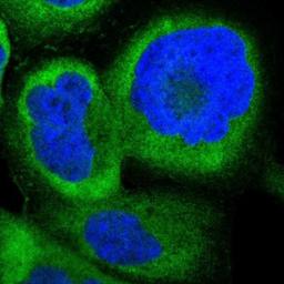 Immunocytochemistry/Immunofluorescence: NME1-NME2 Antibody [NBP1-80992] - Staining of human cell line A-431 shows positivity in cytoplasm.