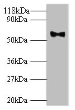 Western blot. All lanes: Major capsid protein L1 antibody at 2ug/ml + 293T whole cell lysate. Secondary. Goat polyclonal to rabbit IgG at 1/10000 dilution. Predicted band size: 62 kDa. Observed band size: 62 kDa. 