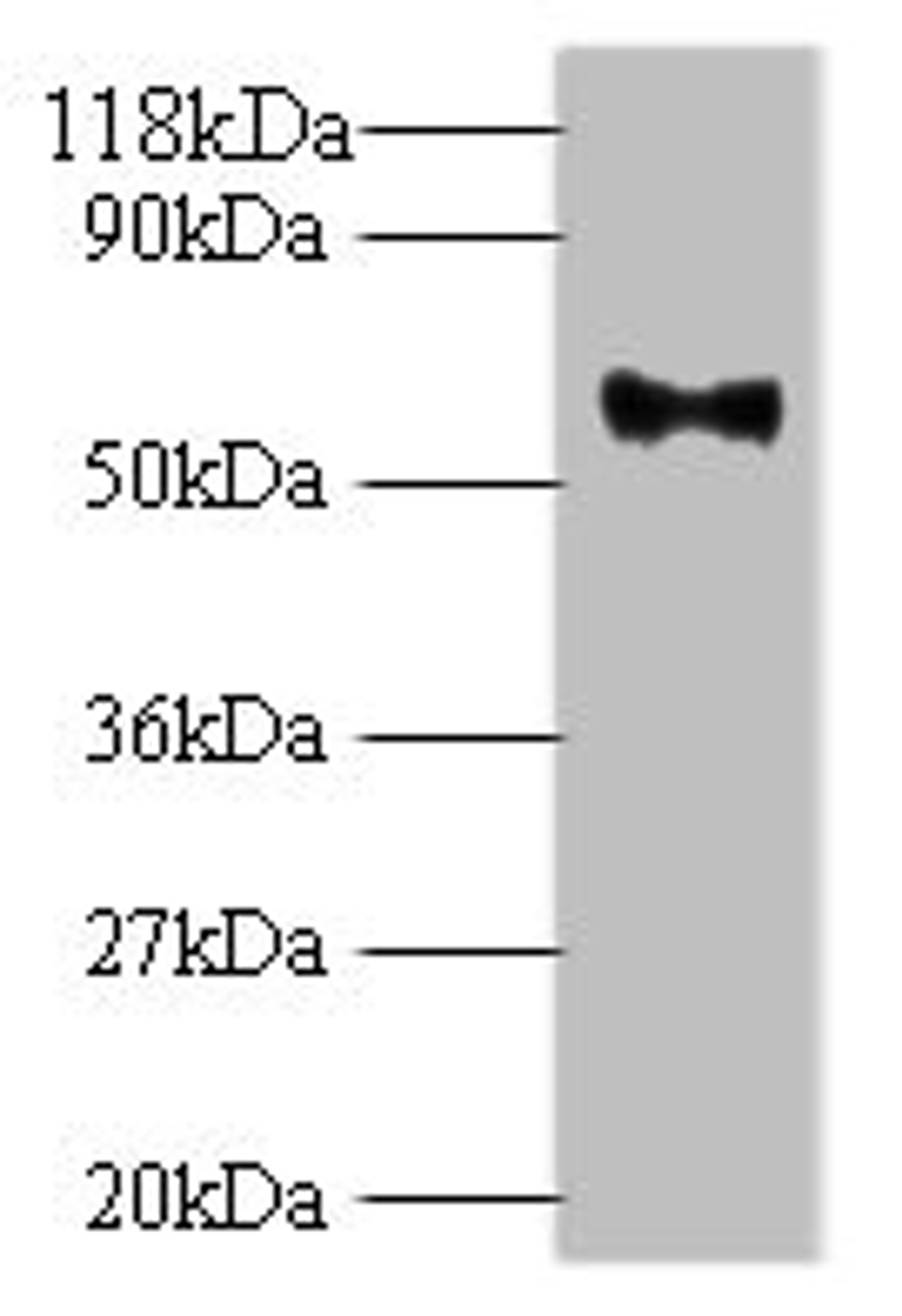 Western blot. All lanes: Major capsid protein L1 antibody at 2ug/ml + 293T whole cell lysate. Secondary. Goat polyclonal to rabbit IgG at 1/10000 dilution. Predicted band size: 62 kDa. Observed band size: 62 kDa. 