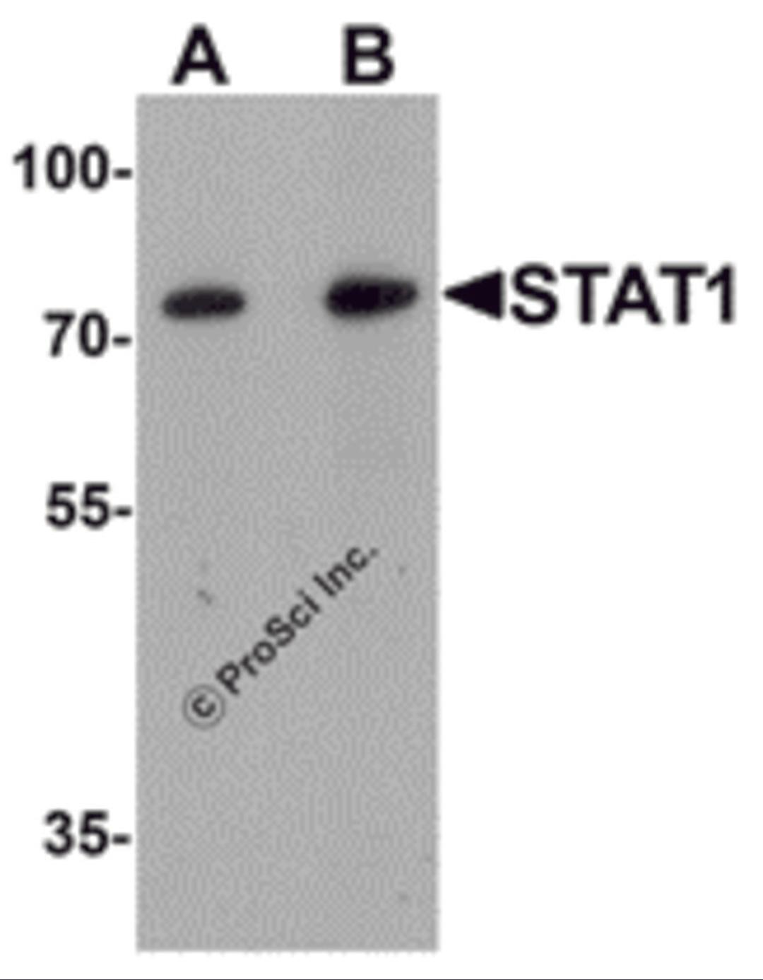 Western blot analysis of STAT1 in human small intestine tissue lysate with STAT1 antibody at (A) 1 and (B) 2 &#956;g/mL.