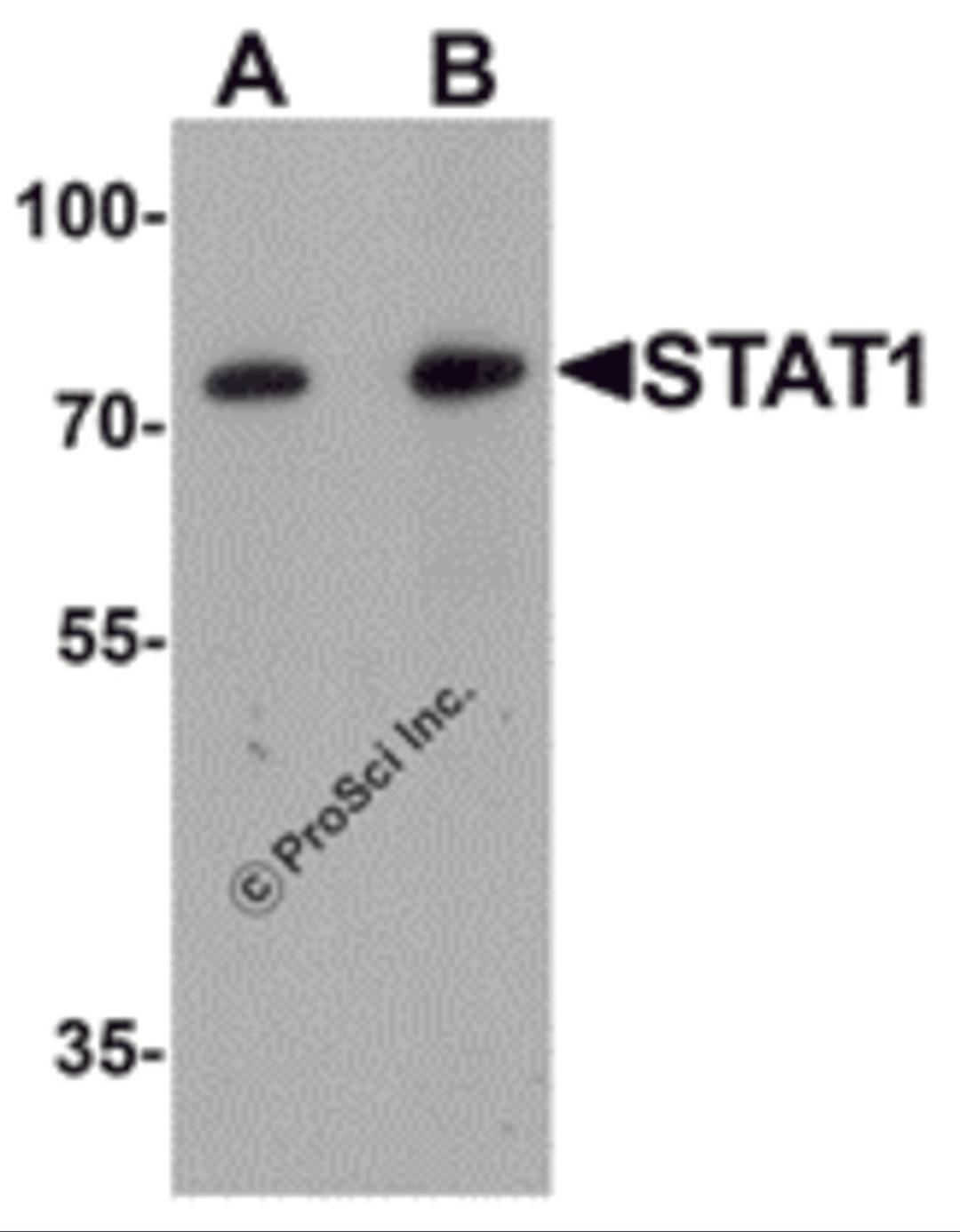 Western blot analysis of STAT1 in human small intestine tissue lysate with STAT1 antibody at (A) 1 and (B) 2 μg/mL.