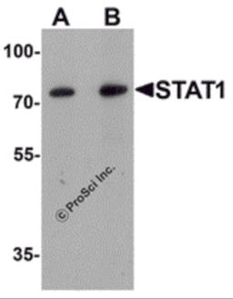 Western blot analysis of STAT1 in human small intestine tissue lysate with STAT1 antibody at (A) 1 and (B) 2 μg/mL.