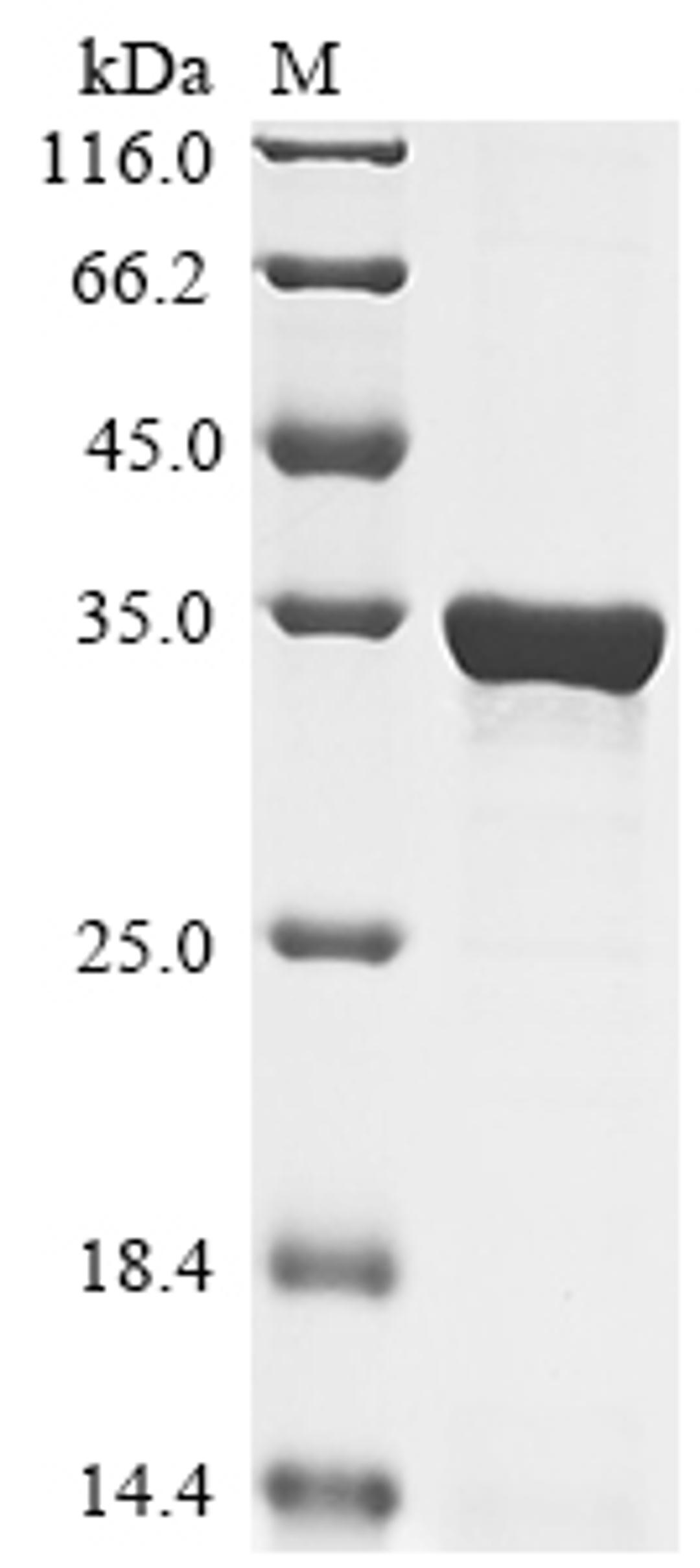 (Tris-Glycine gel) Discontinuous SDS-PAGE (reduced) with 5% enrichment gel and 15% separation gel.